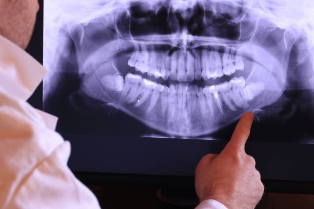Best Walk-In Emergency Dentist in Carthage, TX